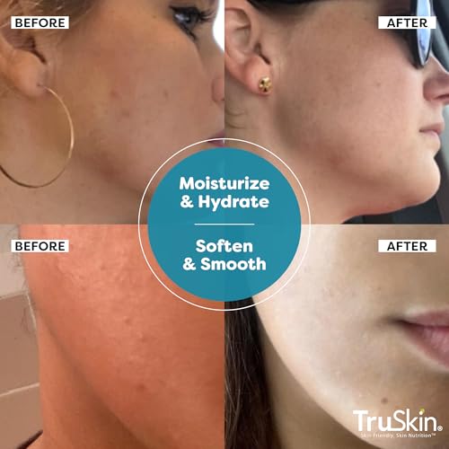 TruSkin Hyaluronic Acid Serum for Face + 7 Ultra Hydrating Ingredients ā Best Face Serum for Moisturizing, Visibly Plumping Skin & Smoothing the Look of Fine Lines, 1 fl oz