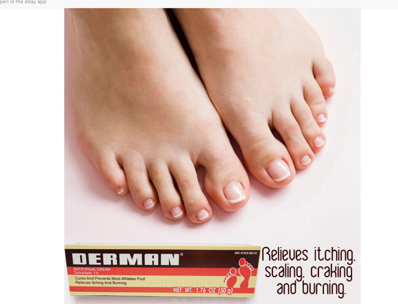 Derman Antifungal Cream. For the Treatment of Athlete's Foot. 1.76 oz. Pack of 3