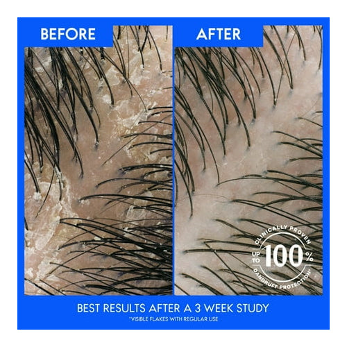 Head and Shoulders Dandruff Shampoo and Conditioner Dual Pack, Dry Scalp Care, 12.5oz and 10.9oz