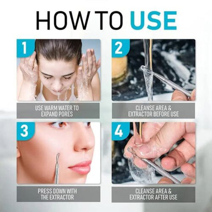 Professional Blackhead Extractor Tool (Stainless Steel) Pimple Popper for Acne, Whiteheads, and Blackheads Best for Facial Skin Care and Pore Minimization