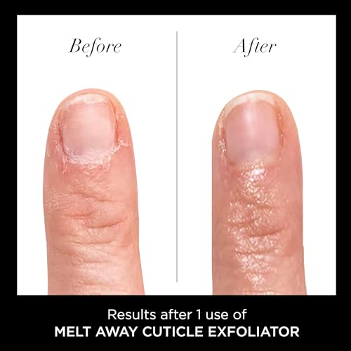 LONDON Cuticle Remover Liquid, Melt Away - Cuticle Softener Oil Exfoliator Gently Removes Dry & Overgrown Skin - Nail Care for Clean & Healthy-Looking Nails, Home Manicure & Pedicure, 6ml