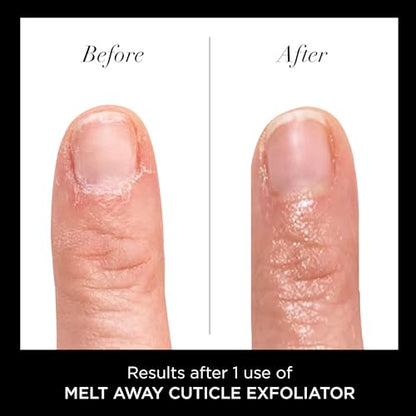 LONDON Cuticle Remover Liquid, Melt Away - Cuticle Softener Oil Exfoliator Gently Removes Dry & Overgrown Skin - Nail Care for Clean & Healthy-Looking Nails, Home Manicure & Pedicure, 6ml