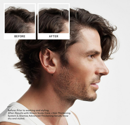 NIOXIN System 2 Scalp Care Conditioner, Hair Thickening For Natural Hair 10 floz