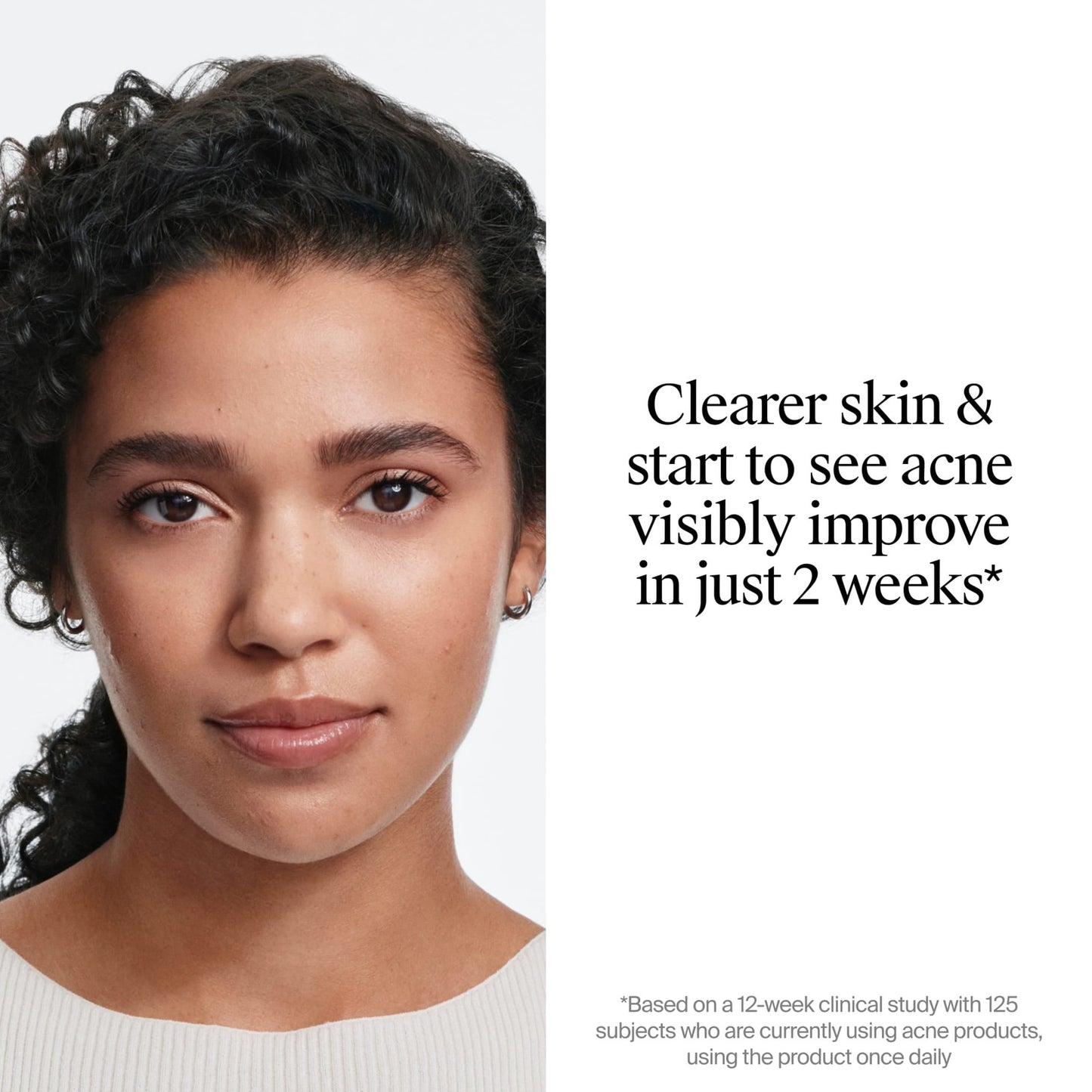 Neutrogena Evenly Clear Retinoid, Adapalene Gel 0.1%, 0.5 oz